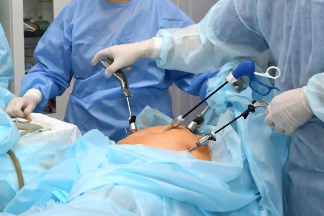 Gall Bladder Surgery
