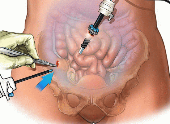 Surgery Image 1